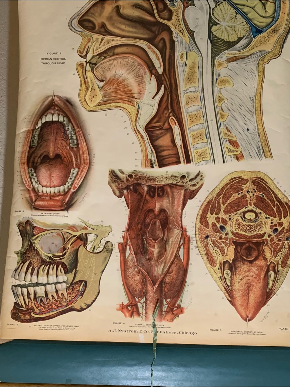 Antique American Frohse Anatomical Chart Head and Neck Signed Max Brotel 1919 - Picture 4 of 16